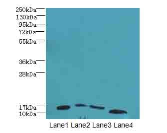 DNAL4 / Dynein Light Chain 4 Antibody