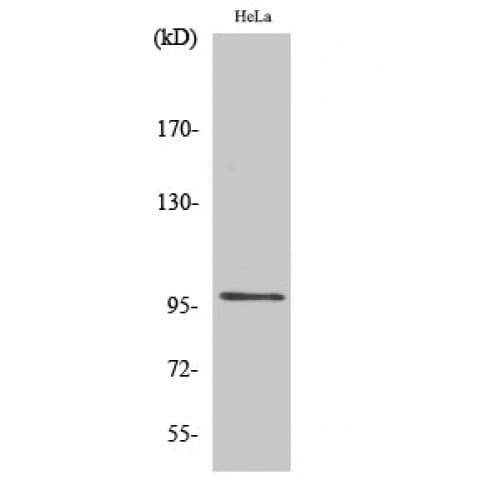 UBTF / UBF Antibody (470-550 aa, Internal)