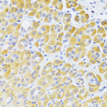 CD95 / FAS Antibody