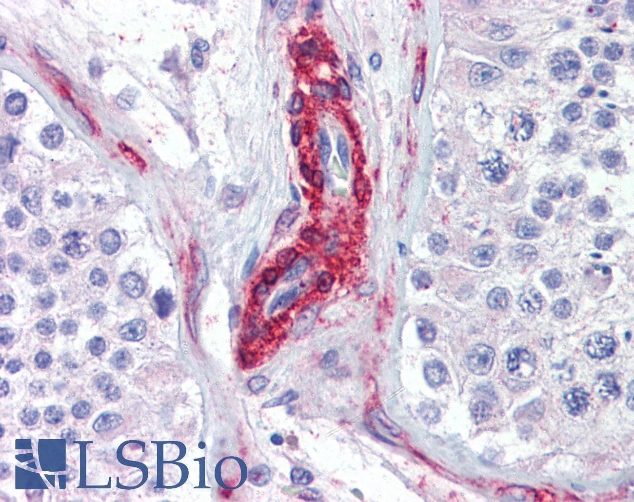 IHC-plus™ PRKG Antibody