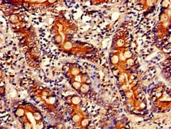 Polyclonal Rabbit anti-Human PITX2 / RGS Antibody (IHC, IF, WB)