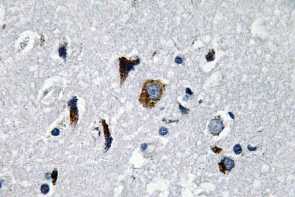 ACE / CD143 Antibody (aa891-940)