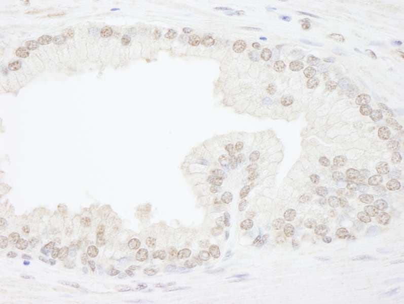 ATRX Antibody (aa2442-C-term)