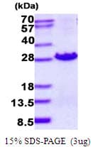 Human MOCS2 Protein (Recombinant His)