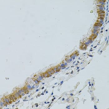 Polyclonal Rabbit anti-Human APG5 / ATG5 Antibody (IHC)