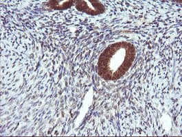 Monoclonal Mouse anti-Human DDT / Dopamine Tautomerase Antibody (clone OTI1A1, IHC, WB)