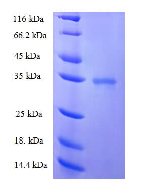 Human CETN2 / Centrin 2 Protein (Recombinant His-SUMO)