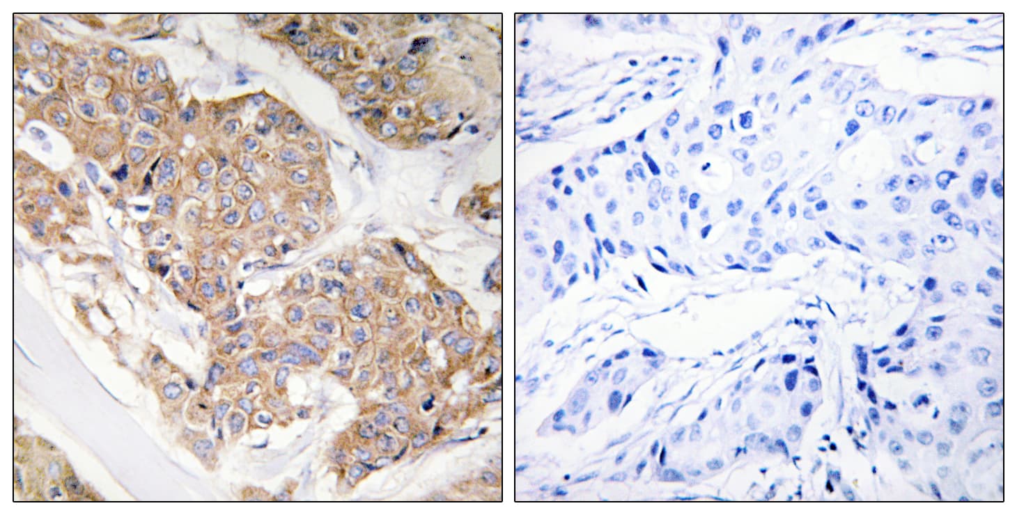 Polyclonal Rabbit anti-Human IL13RA1 / IL13R Alpha 1 Antibody (aa371-420, IHC, IF, WB)