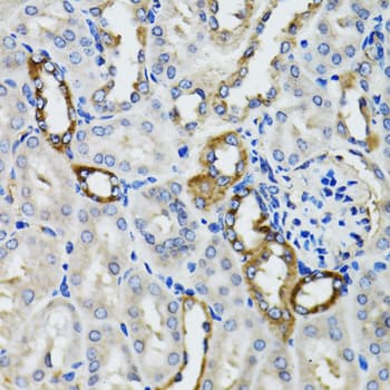Polyclonal Rabbit anti-Human BAP29 / BCAP29 Antibody (IHC, WB)