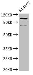 Polyclonal Rabbit anti-Human ACTN4 Antibody (IHC, WB)