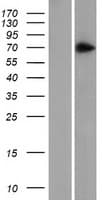 Human ZNF639 Protein (Over-Expression Lysate Myc-DDK (Flag))