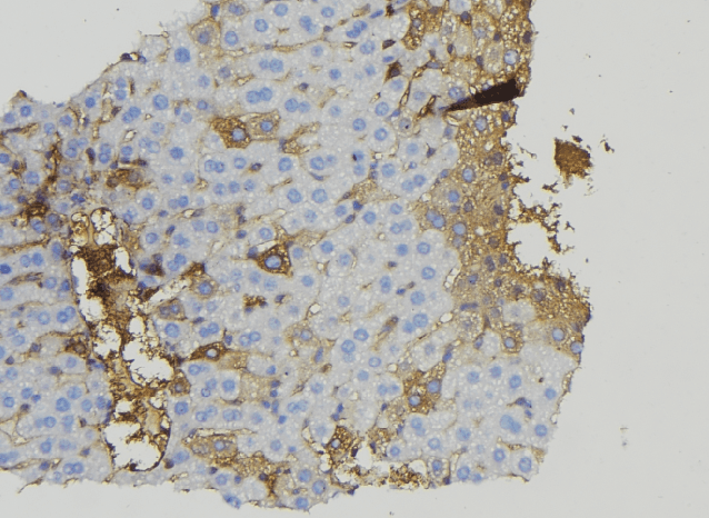 BRP44L Antibody