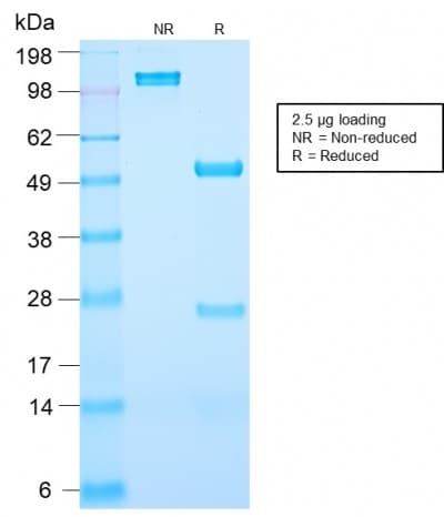 PathPlus™ Recombinant Monoclonal Rabbit anti-Human KLK3 / PSA Antibody (clone KLK3/2871R, IHC)