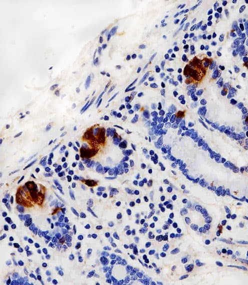 LYZ / Lysozyme Antibody (aa119-154)