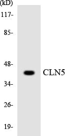 CLN5 Antibody (aa159-208)