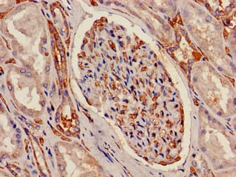 ATP5C1 Antibody