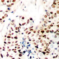 ZNF75 / ZNF75D Antibody (C-Terminus)