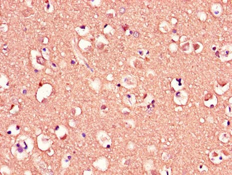 Polyclonal Rabbit anti-Human MED12 Antibody (IHC)