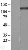 Human TPP2 Protein (Over-Expression Lysate Myc-DDK (Flag))