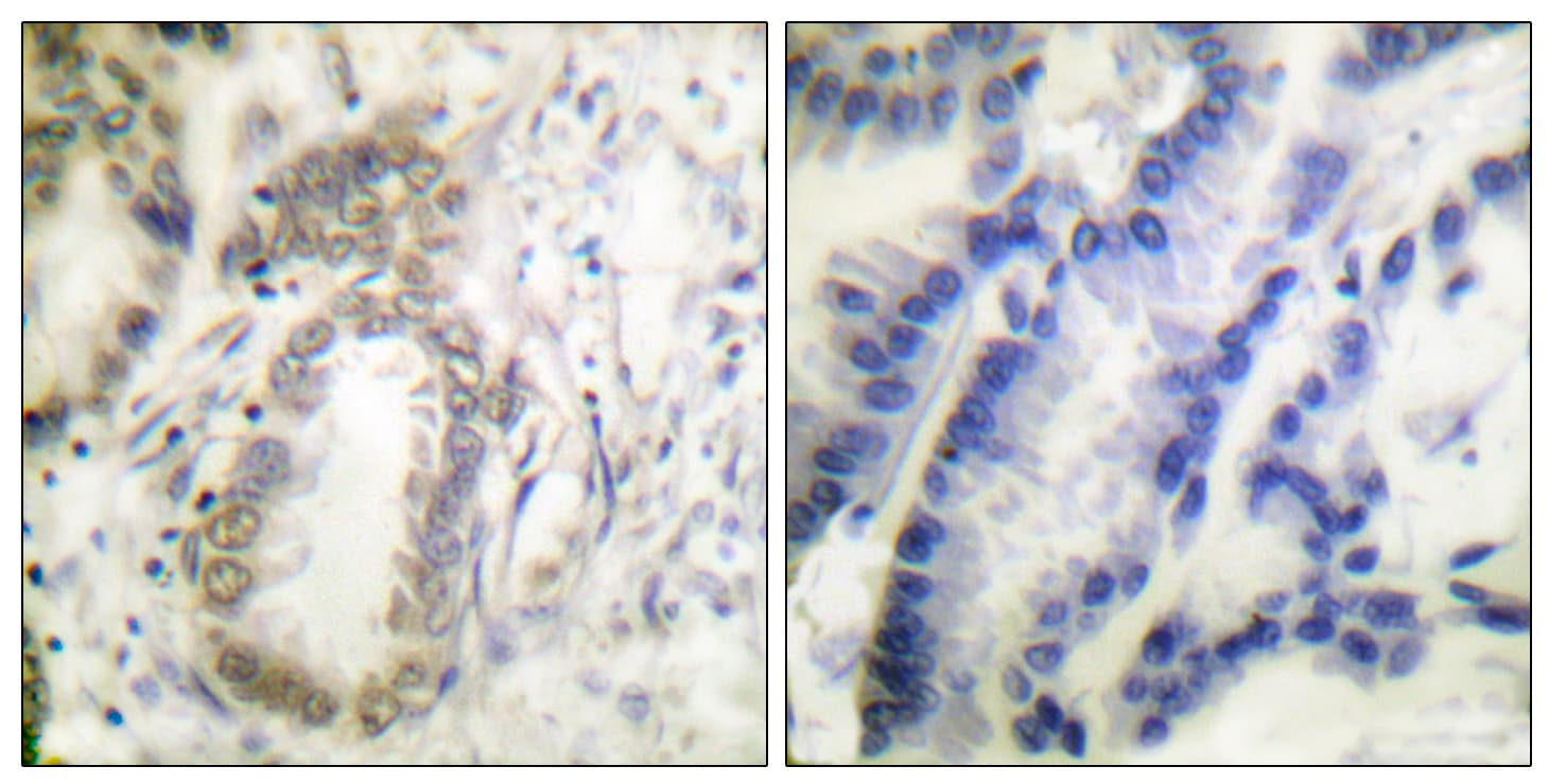 Polyclonal Rabbit anti-Human C/EBP Alpha / CEBPA Antibody (phospho-Ser21, IHC, WB)