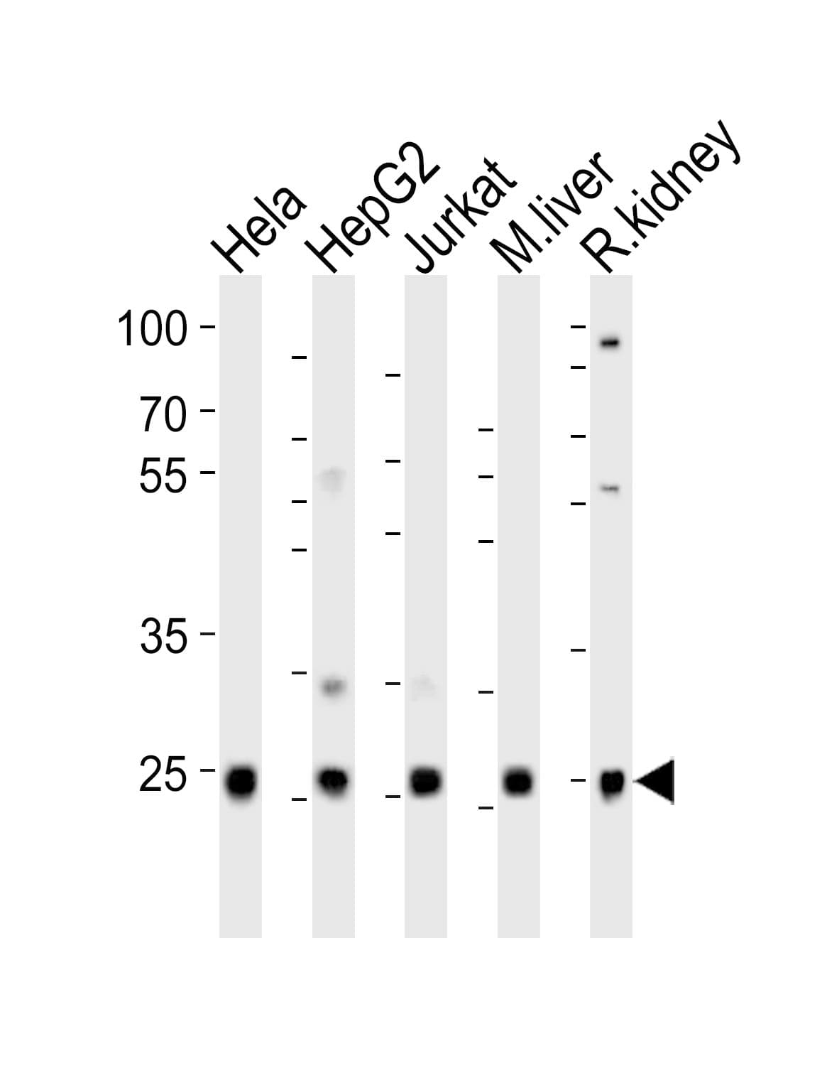 UBB / Ubiquitin B Antibody (aa25-57)