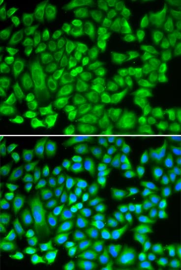 Polyclonal Rabbit anti-Human KAT5 / TIP60 Antibody (IHC, IF, WB)