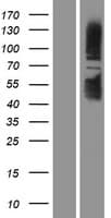 SIRT1 / Sirtuin 1 Protein (Over-Expression Lysate Myc-DDK (Flag))