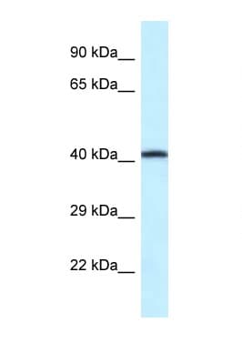 P2RX2 / P2X2 Antibody (aa90-139)