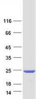 Human CENPM Protein (Recombinant Myc-DDK (Flag))
