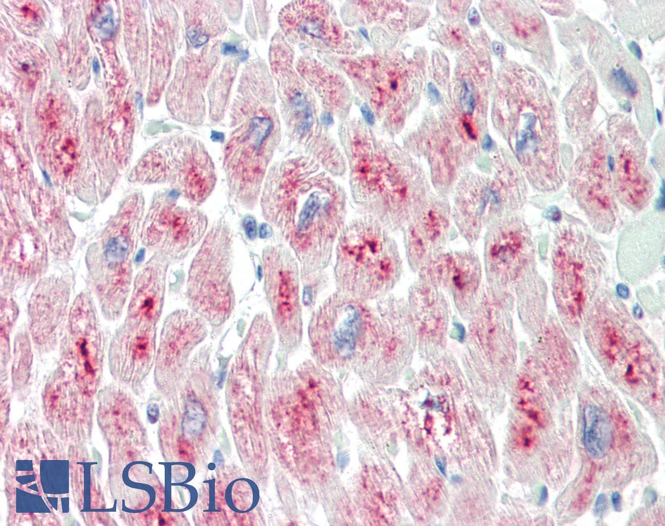 IHC-plus™ TRIM55 / MURF2 Antibody (aa536-548)