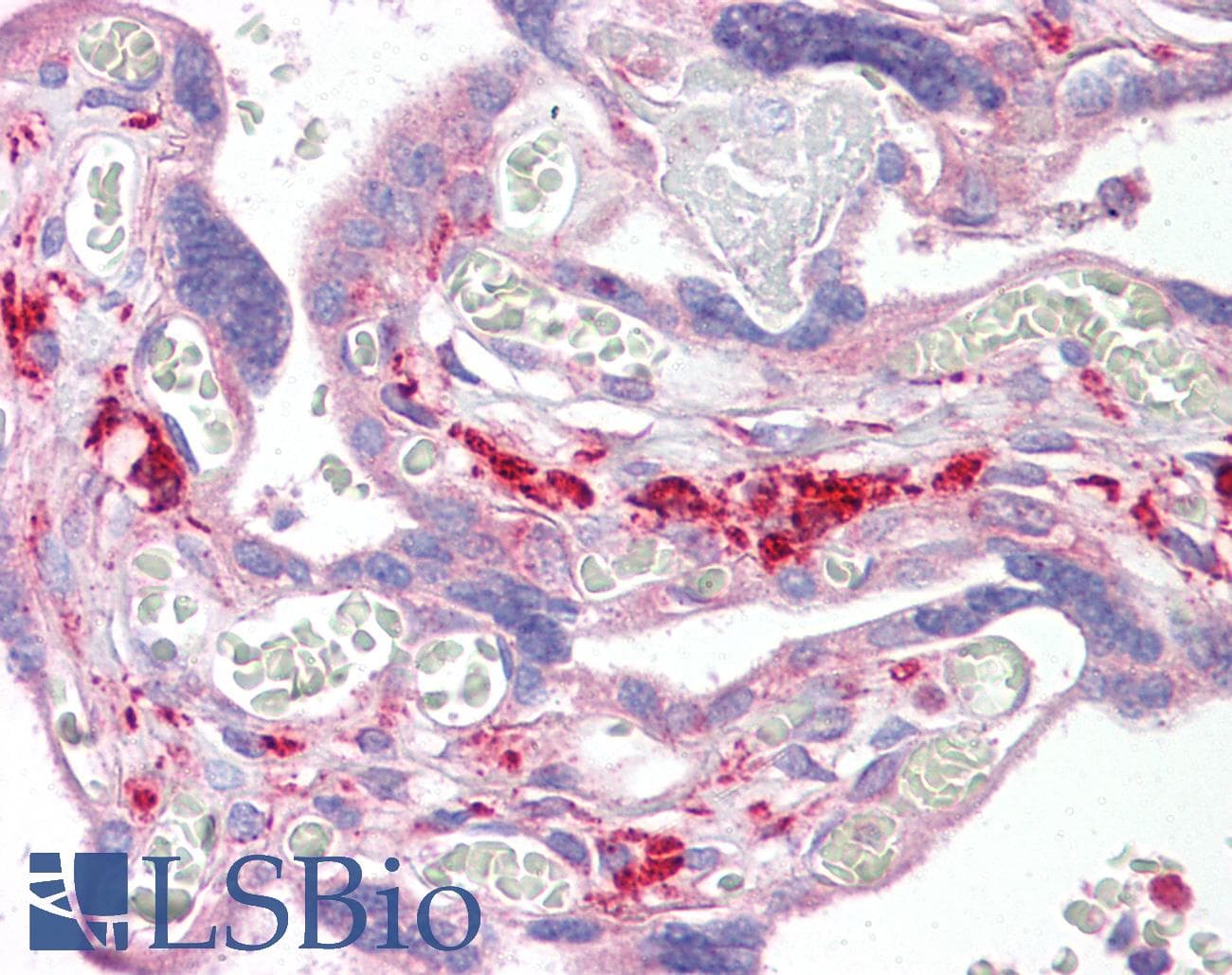 IHC-plus™ Polyclonal Rabbit anti-Human SNX2 Antibody (aa120-170, IHC, WB)