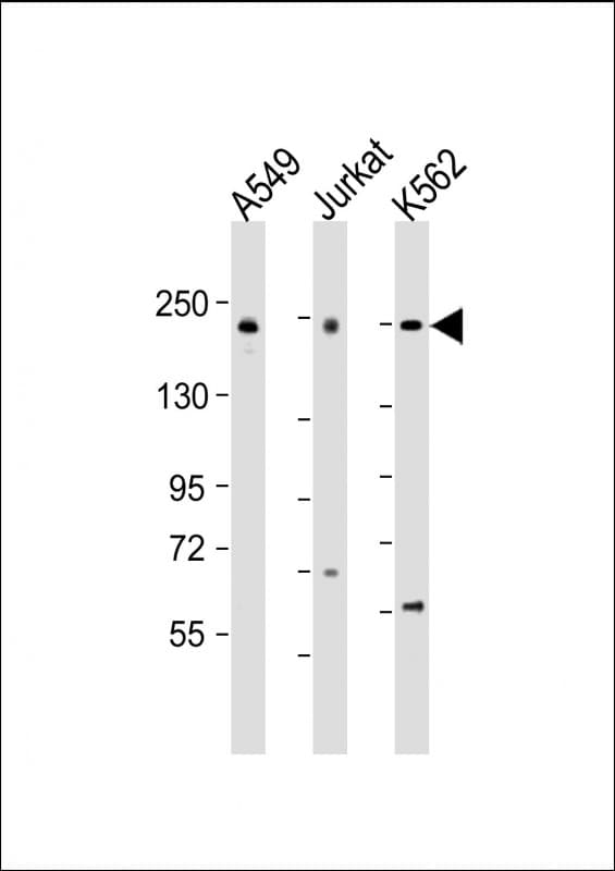 PSME4 / PA200 Antibody (aa503-535)