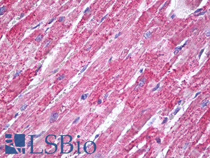 PathPlus™ SOD2 / Mn SOD Antibody