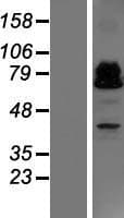 ZBTB46 Protein (Over-Expression Lysate Myc-DDK (Flag))