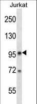 Polyclonal Rabbit anti-Human SR140 / U2SURP Antibody (aa33-62, WB)