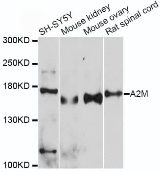 Polyclonal Rabbit anti-Human A2M / Alpha-2-Macroglobulin Antibody (IHC, WB)