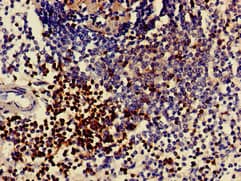 Polyclonal Rabbit anti-Human CD3E Antibody (IHC, IF)