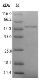 Human CBR4 Protein (Recombinant GST, N-terminus)