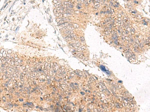 IDUA / MPS1 Antibody