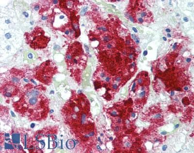 IHC-plus™ PIGF Antibody (130-210 aa, C-terminal)
