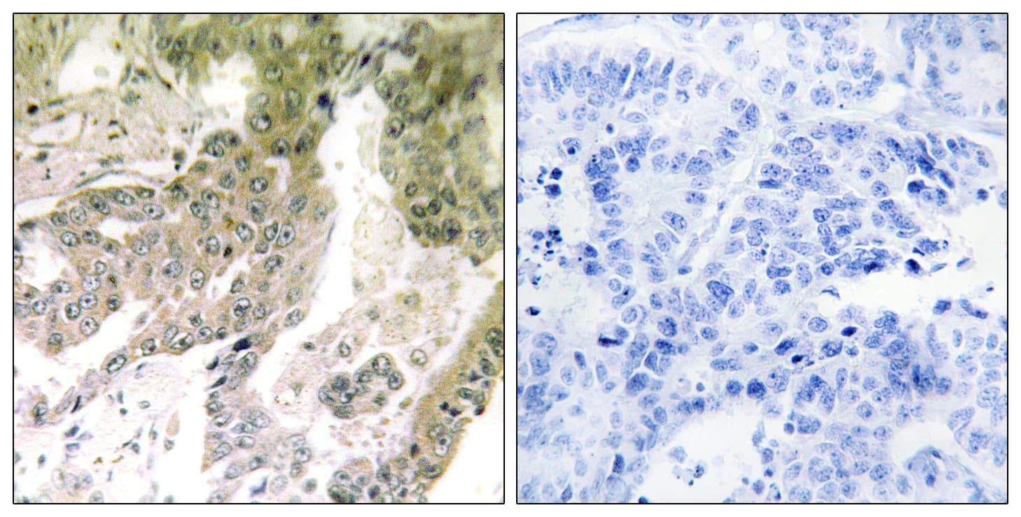 Polyclonal Rabbit anti-Human LAMA5 / Laminin Alpha 5 Antibody (aa2381-2430, IHC)
