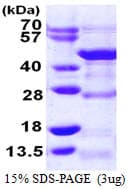 Human DRG1 / NEDD3 Protein (Recombinant His)