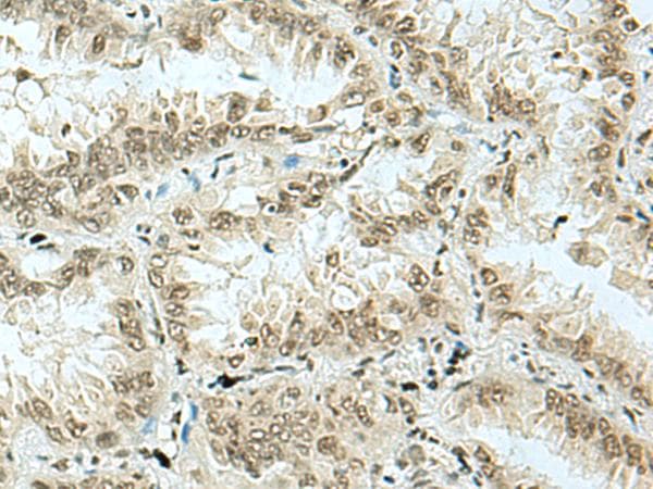 HAS1 / HAS Antibody
