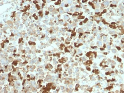 NGFR / CD271 / TNR16 Antibody (aa 281-421, clone NGFR/2550R)
