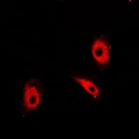 TPI1 / TPI Antibody