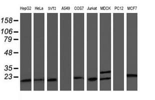 C1orf50 Antibody (clone OTI1C6)
