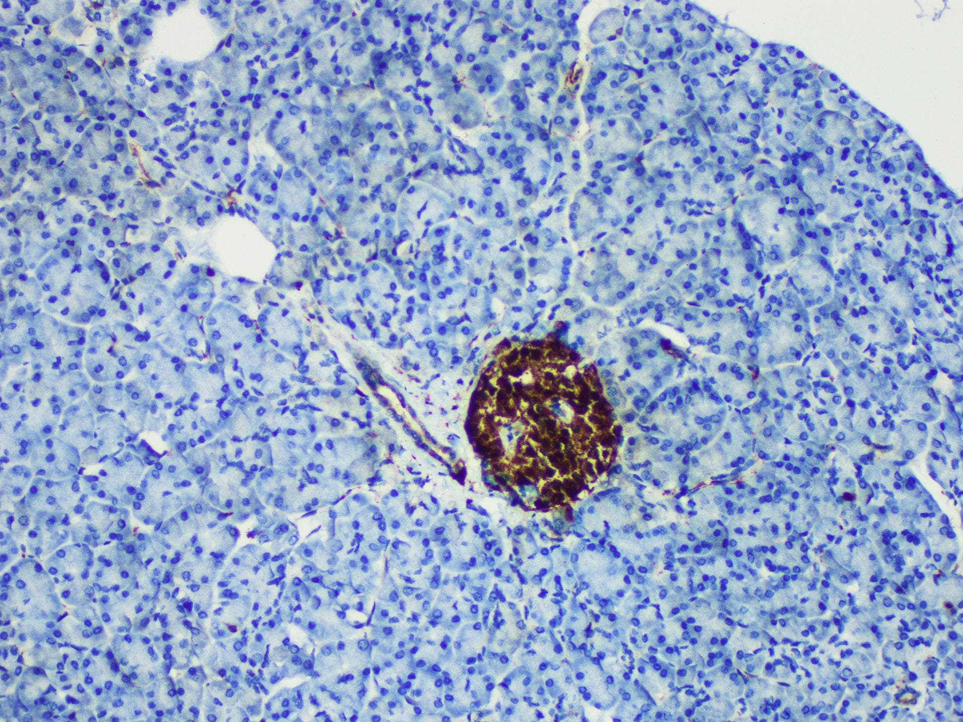 ENO2 / NSE Antibody