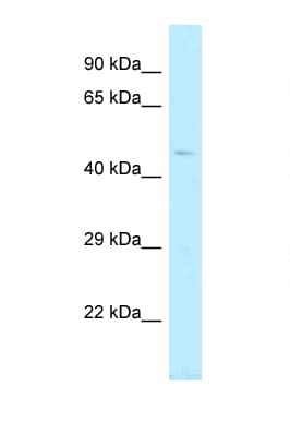 TBC1D20 Antibody (aa318-367)