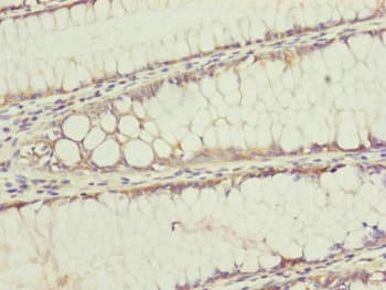 TIMM17B Antibody