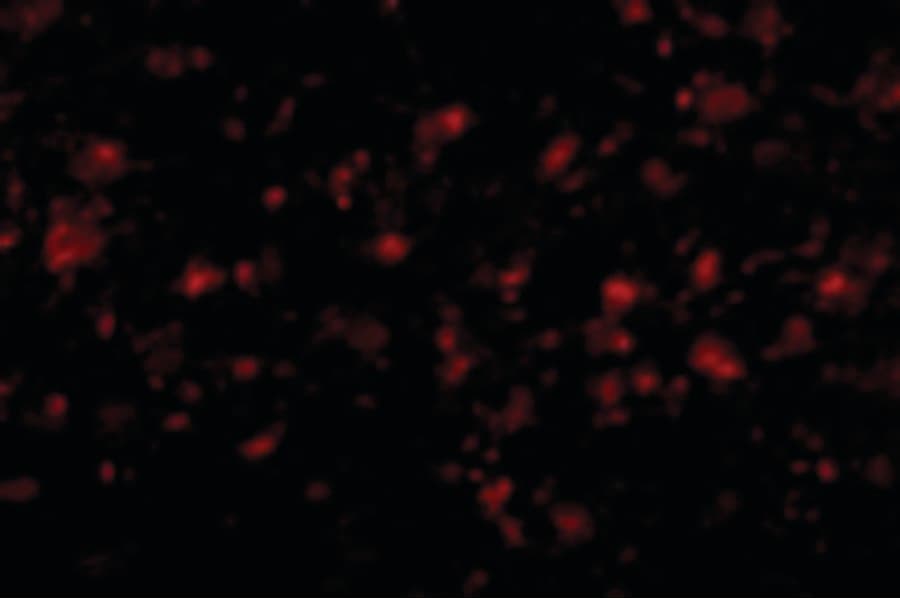 MC4R / Melanocortin 4 Receptor Antibody